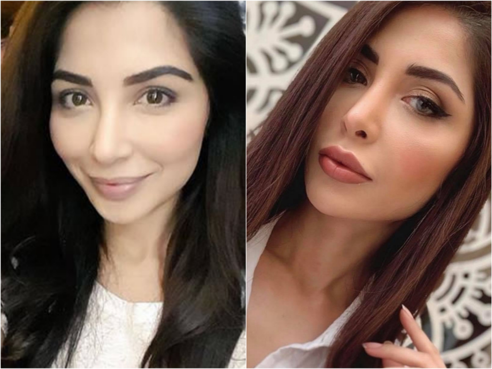 Pakistani celebrities - nose job