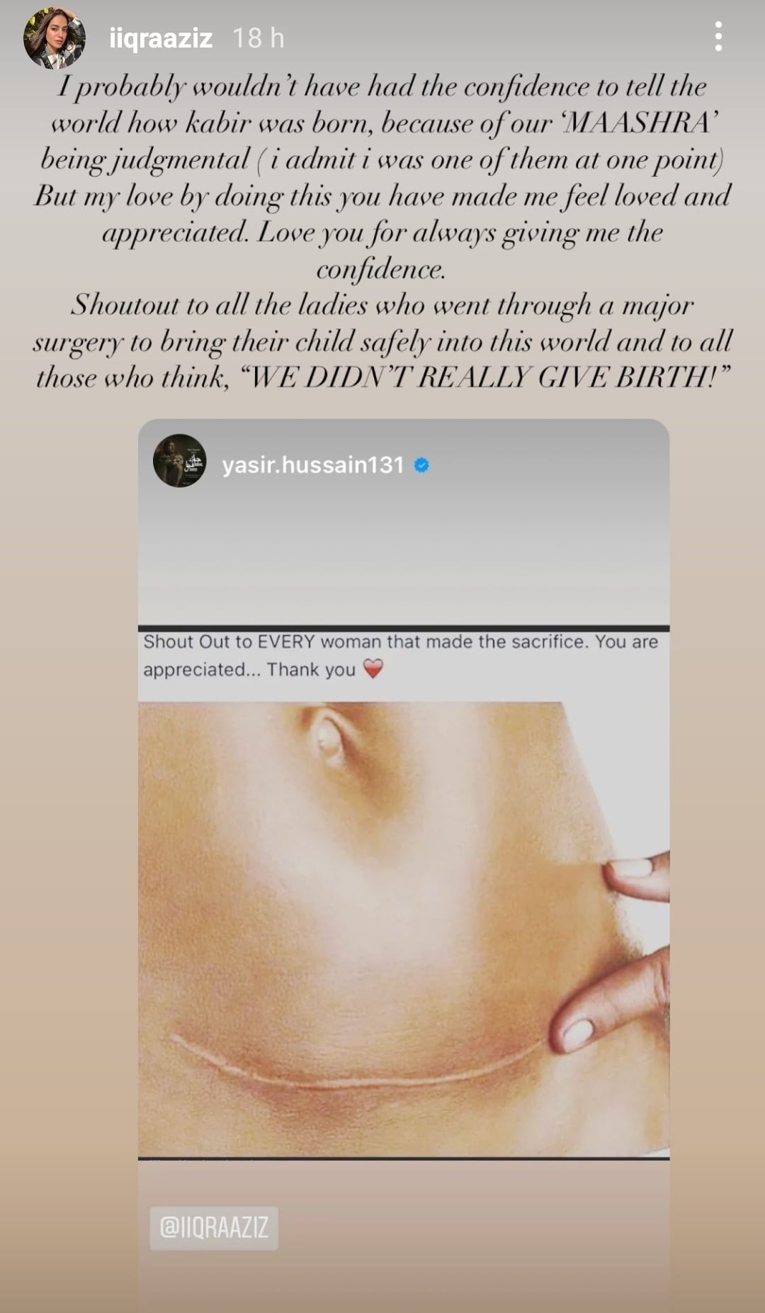Iqra Aziz C-section