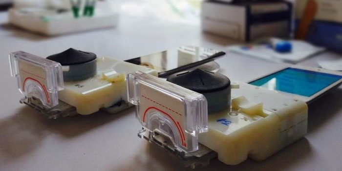 smartphone hiv test