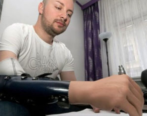 bionic hand