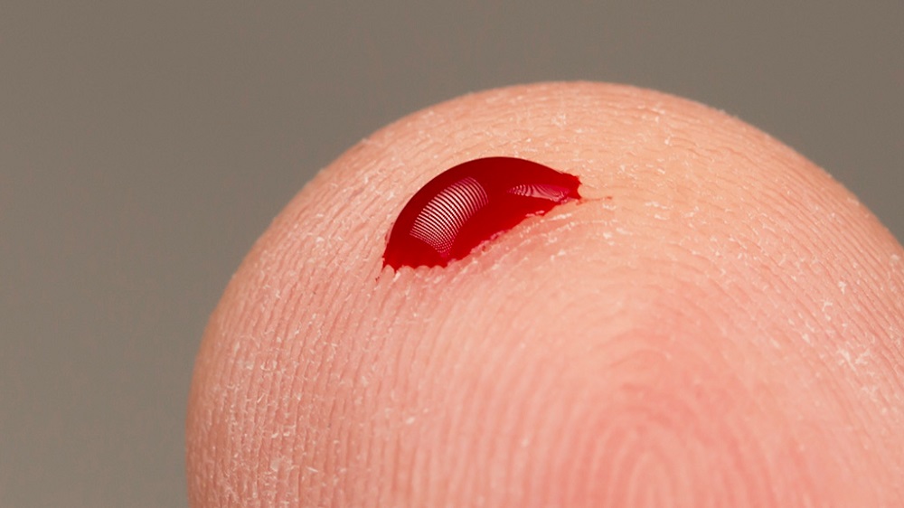 This Sensor Detects Diseases from a Single Drop of Blood