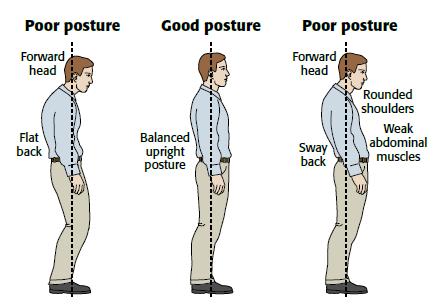 poor standing posture vs good standing posture