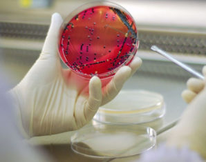 Anti-Microbial Resistance Levels