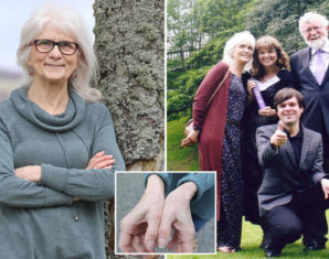 This Woman Feels No Pain and Heals Without Scarring | propakistani.pk