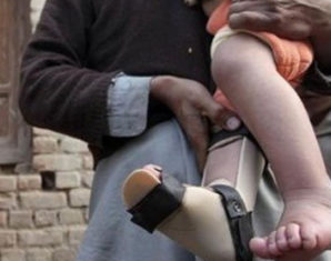 Rehab Center for polio Victims Goes Operational in Hayatabad