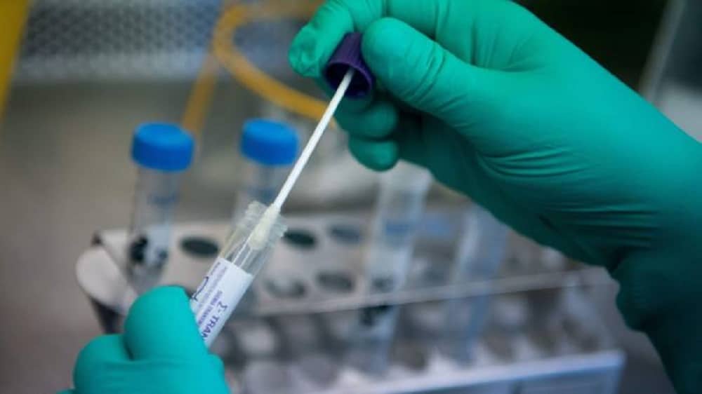 Sindh Govt Begins Free Home Test Service for Coronavirus