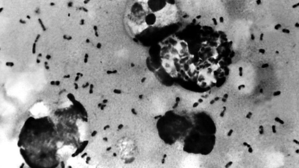 The Deadly Bubonic Plague is Back in China
