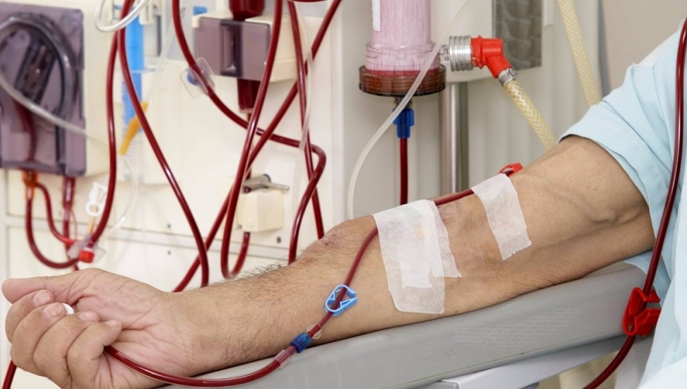 Lahore-Based Startup Invents Pakistan’s First Affordable and Bloodless Dialysis Machine