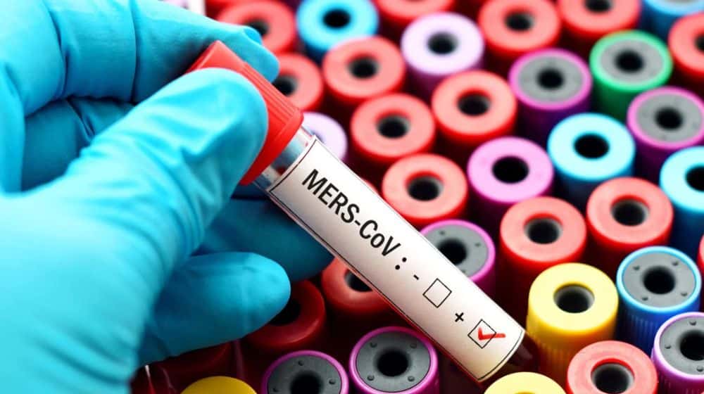 UAE Detects MERS That is 16 Times Deadlier Than COVID-19
