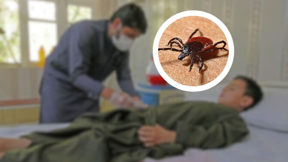Govt Warns of Congo Fever After First Reported Case in KP