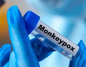 mpox virus