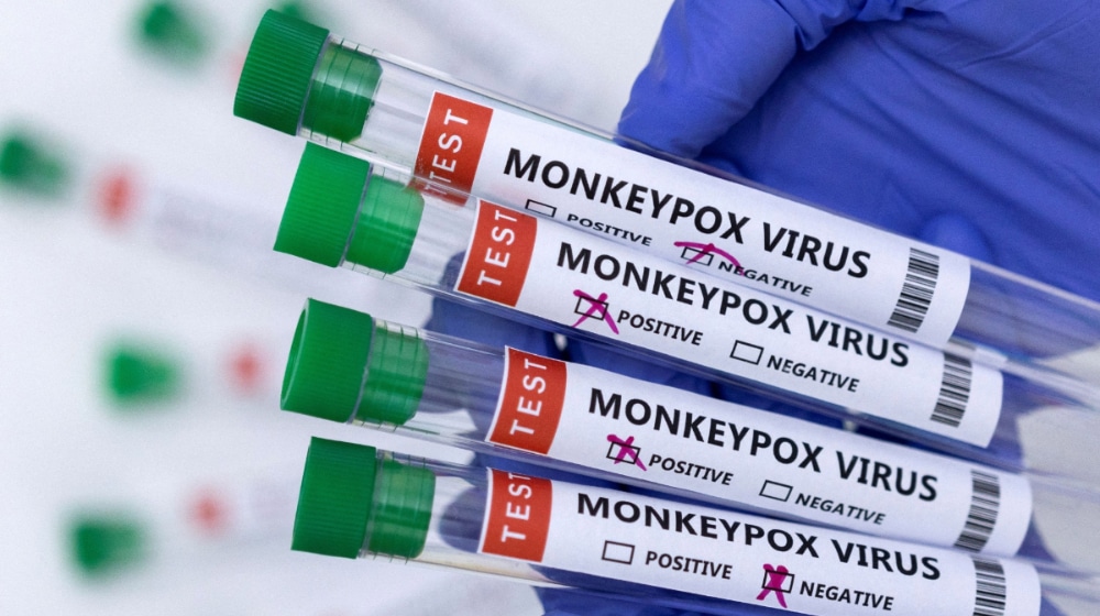 Another Province Reports Suspected Monkeypox Cases After KP