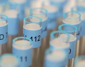 PSB caught several athletes doping