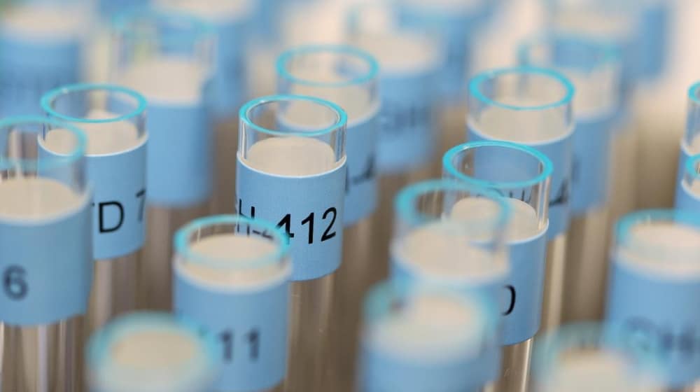 PSB caught several athletes doping