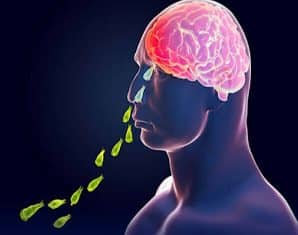 Naegleria fowleri cases in Karachi