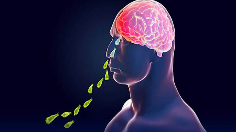 Naegleria fowleri cases in Karachi