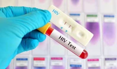 HIV Cases